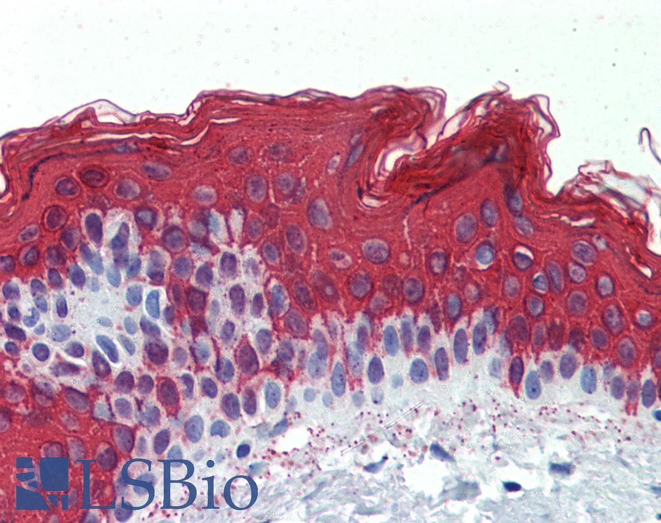 KRT1 / CK1 / Cytokeratin 1 Antibody (C-Terminus)