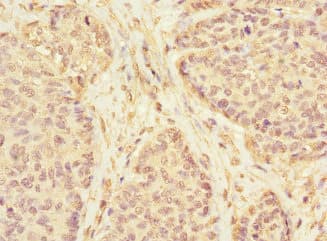 Polyclonal Rabbit anti-Human KLHL13 Antibody (IHC, WB)