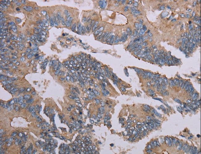 MMP20 Antibody