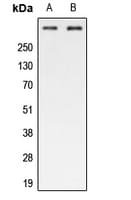 Polyclonal Rabbit anti-Human ATM Antibody (phospho-Ser1987, WB)