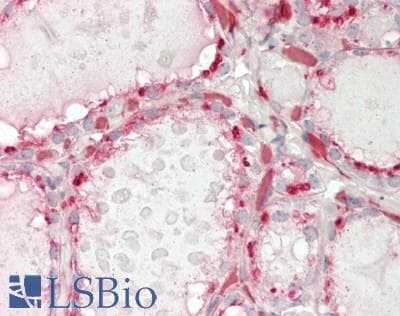 IHC-plus™ Polyclonal Rabbit anti-Human LRIG2 Antibody (aa817-845, IHC, WB)