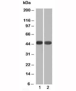 NAPSA / NAPA / Napsin A Antibody (clone NAPSA/1239, Ready-to-Use)