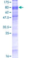 Human SLC7A8 / LAT2 Protein (Recombinant GST)