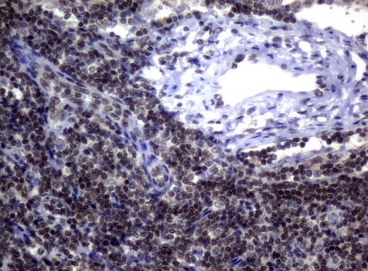 MGMT Antibody (clone UMAB56)