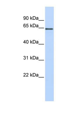 MAOB / Monoamine Oxidase B Antibody (aa36-85)