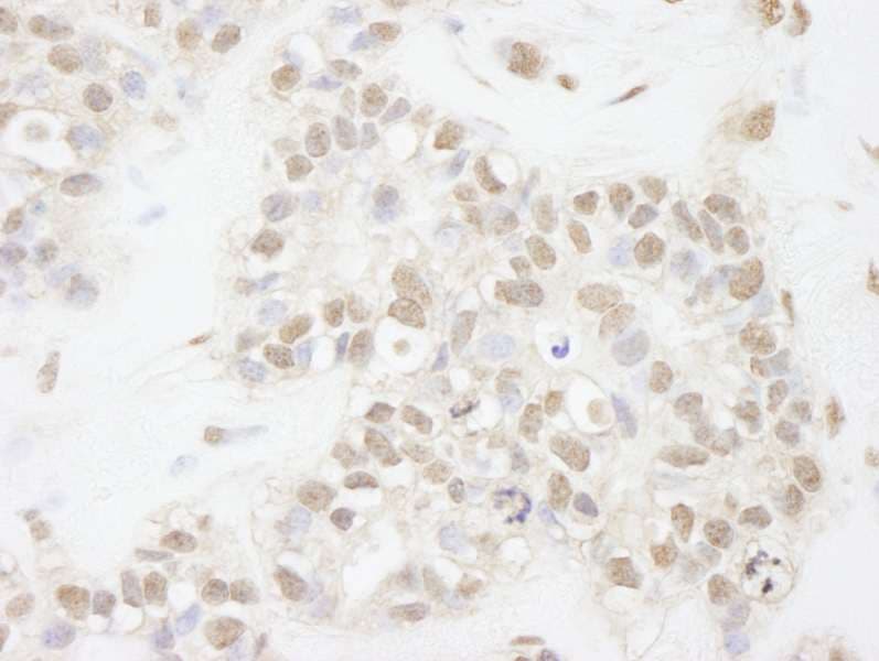 ATRX Antibody (aa2442-C-term)