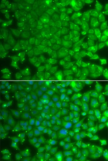 KBTBD7 Antibody