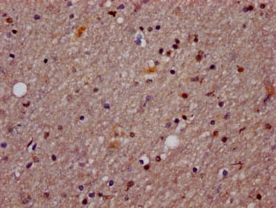 AGO2 / EIF2C2 Antibody (aa517-818)