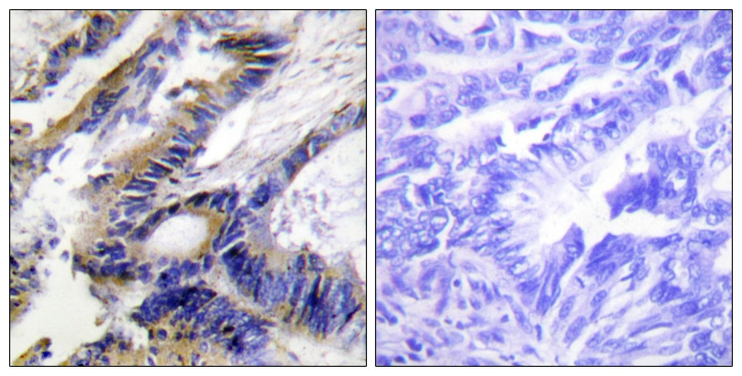 ILKAP Antibody