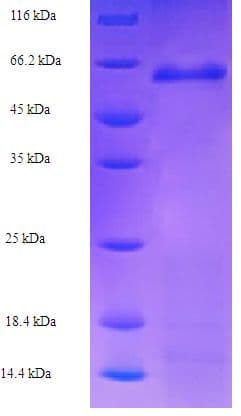 Human FBXL2 Protein (Recombinant His-SUMO)