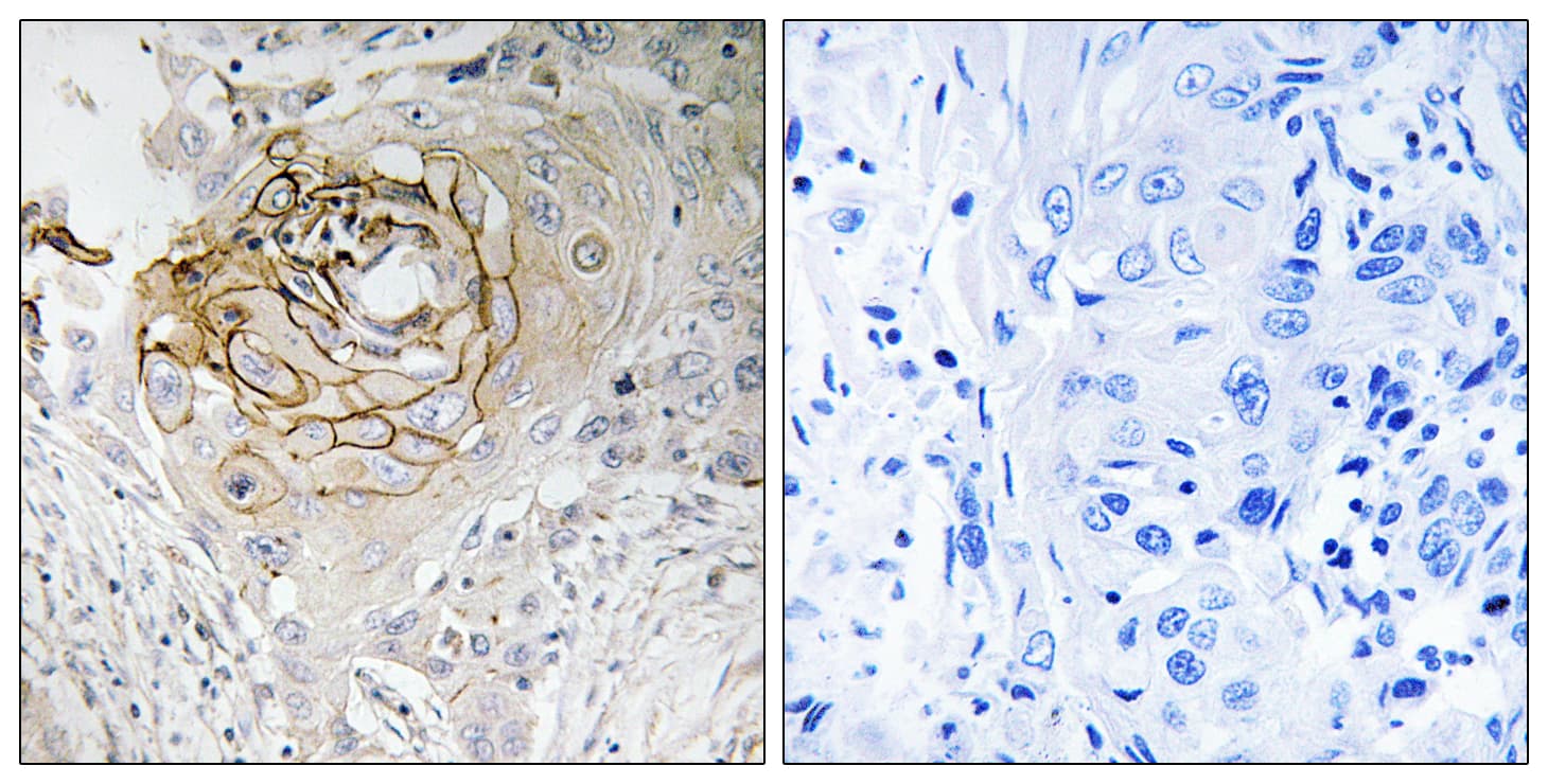 Polyclonal Rabbit anti-Human SCN9A / Nav1.7 Antibody (aa651-700, IHC)