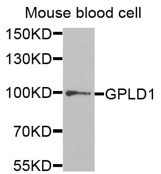 GPLD1 / GPIPLD Antibody