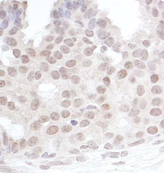 Polyclonal Rabbit anti-Human GEMIN4 Antibody (aa1010-C-term, IHC, WB)