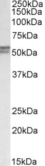 IHC-plus™ Polyclonal Goat anti-Human DGAT1 Antibody (aa67-79, IHC, WB)