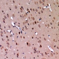 C1GALT1C1 Antibody