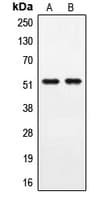Polyclonal Rabbit anti-Human PPHLN1 Antibody (Internal, IHC, IF, WB)