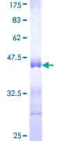 Human COL5A3 / Collagen V Alpha 3 Protein (Recombinant GST, N-terminus)