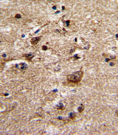 Polyclonal Rabbit anti-Human ADRA1B / Adrenoceptor alpha 1B Antibody (aa270-297, IHC, WB)