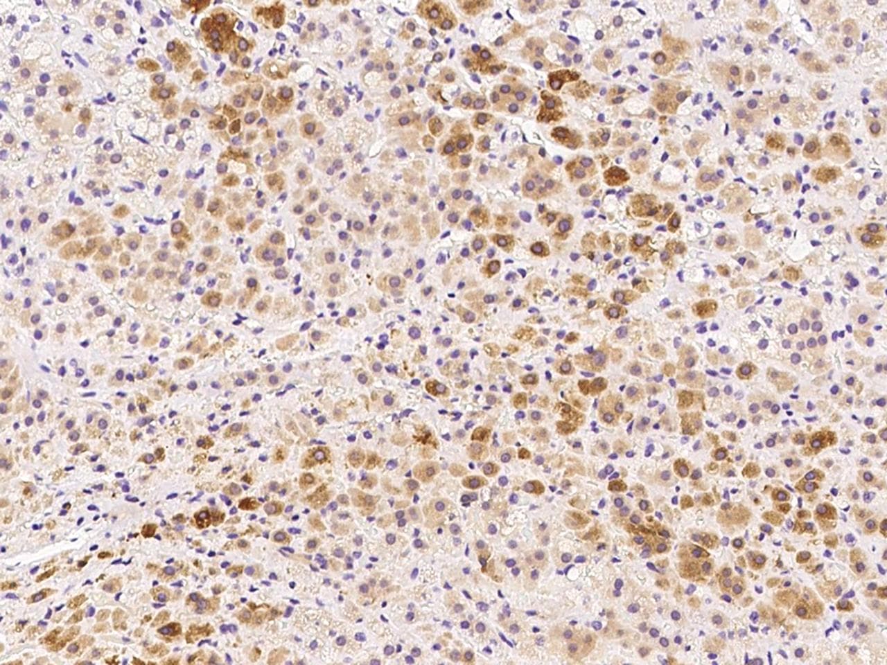 Polyclonal Rabbit anti-Human ADCK3 / CABC1 Antibody (IHC, WB)