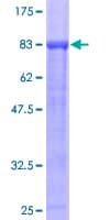Human PPP2R5A Protein (Recombinant GST)