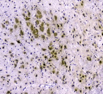 Polyclonal Rabbit anti-Human CDA / Cytidine Deaminase Antibody (IHC, WB)