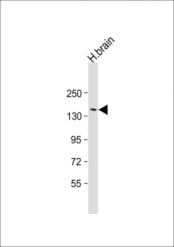 Polyclonal Rabbit anti-Human RTN4 / Nogo Antibody (aa28-58, WB)