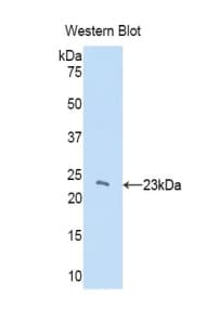 CBX3 / HP1 Gamma Antibody (aa1-183)