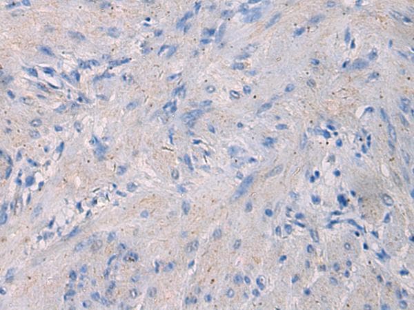 NFKB1 / NF-Kappa-B Antibody
