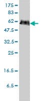 PGM3 Antibody (clone 1E2-1B12)