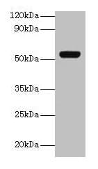 IHC-plus™ GC / Vitamin D-Binding Protein Antibody