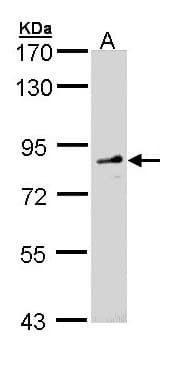 Polyclonal Rabbit anti-Human FGD4 Antibody (aa49-327, IHC, WB)