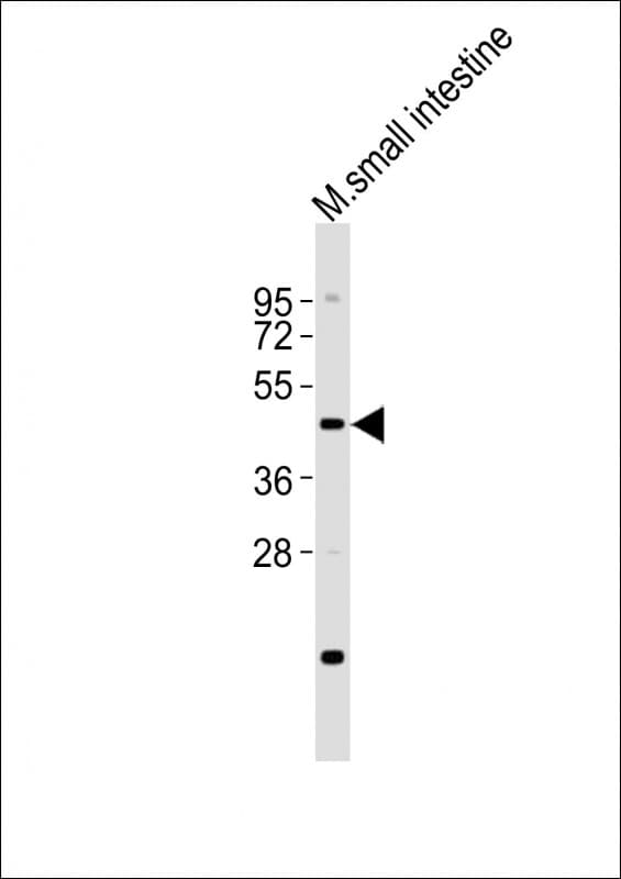 LMX1A Antibody (aa303-337)