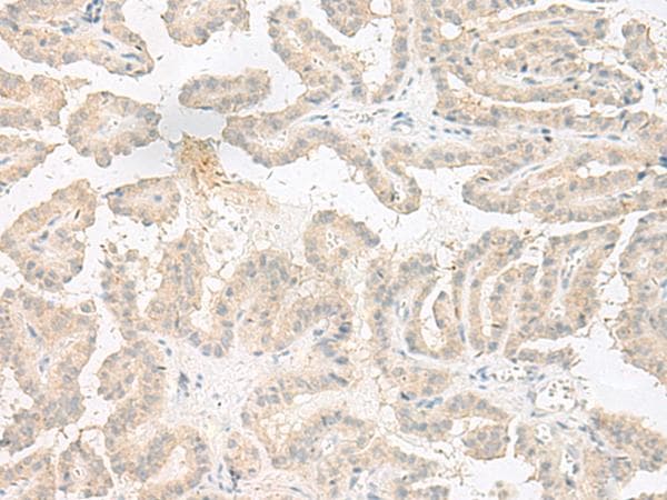 EPRS / PARS Antibody