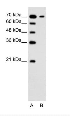 SLC5A4 / SGLT3 Antibody (N-Terminus, FITC)