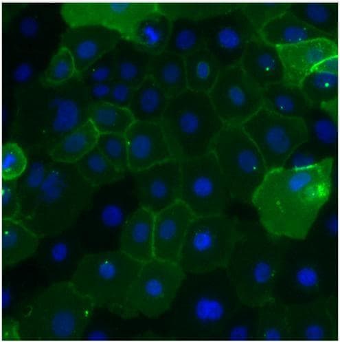 CEACAM5 / CD66e Antibody (clone 1106)