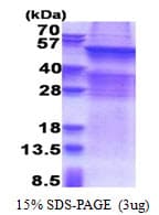 Human UGT8 Protein (Recombinant His)