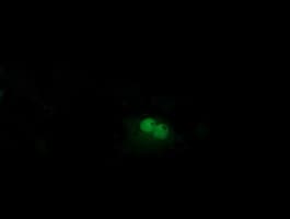 Monoclonal Mouse anti-Human BTRCP / BETA-TRCP Antibody (clone OTI2H2, IF, WB)