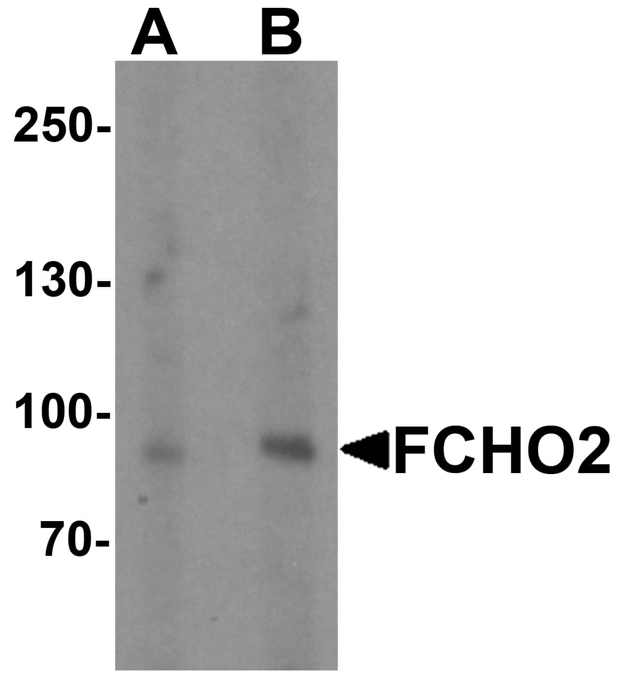 FCHO2 Antibody
