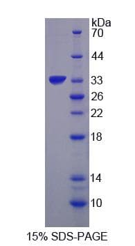 Human UBR4 Protein (Recombinant His-S)