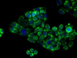 APP / Beta Amyloid Precursor Antibody (clone OTI2B10)