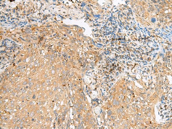 Polyclonal Rabbit anti-Human COPE Antibody (IHC, WB)