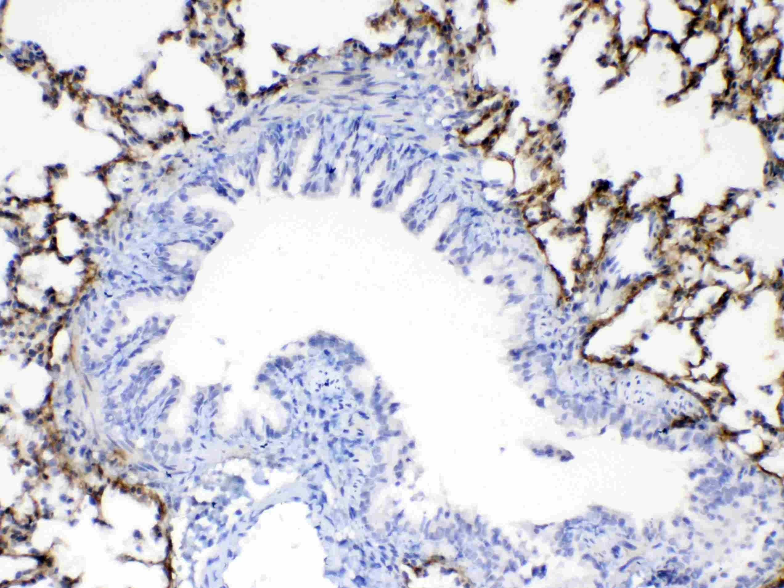 Polyclonal Rabbit anti-Rat POSTN / Periostin Antibody (IHC, WB)