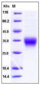 Mouse CD8A / CD8 Alpha Protein (Recombinant His,C-terminus)