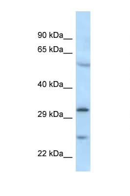 Polyclonal Rabbit anti-Human CMT2 / MAD2L1BP Antibody (N-Terminus, WB)
