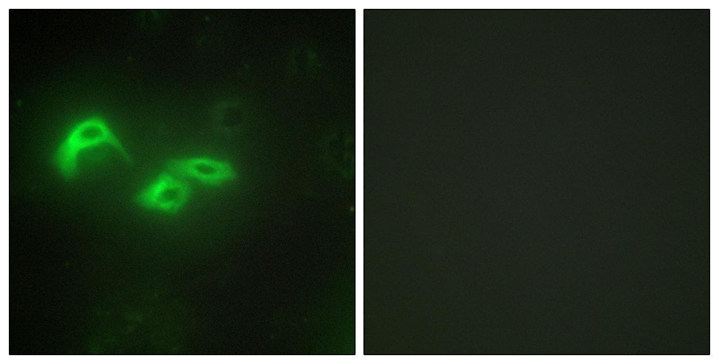 MtTFA / TFAM Antibody