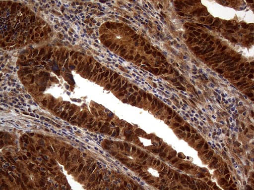 MSH6 Antibody (aa1-280, clone OTI5D1)