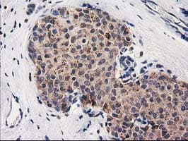 CLPP Antibody (clone OTI1E2, Carrier-free)