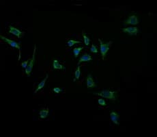 ACAA2 Antibody (clone OTI1D3)