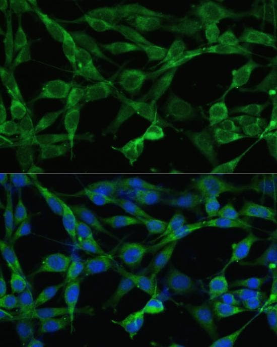 SMAD3 Antibody