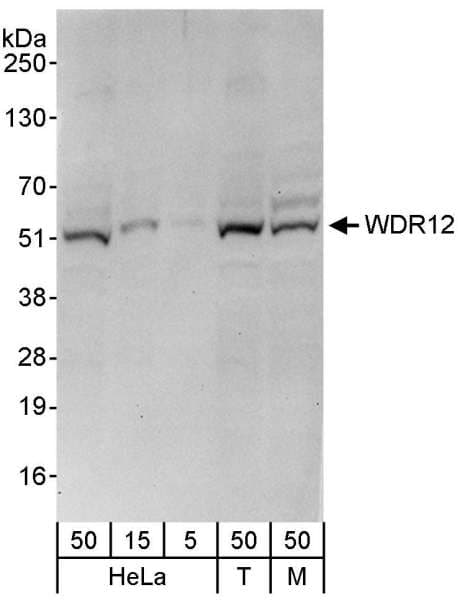 WDR12 Antibody (aa300-350)